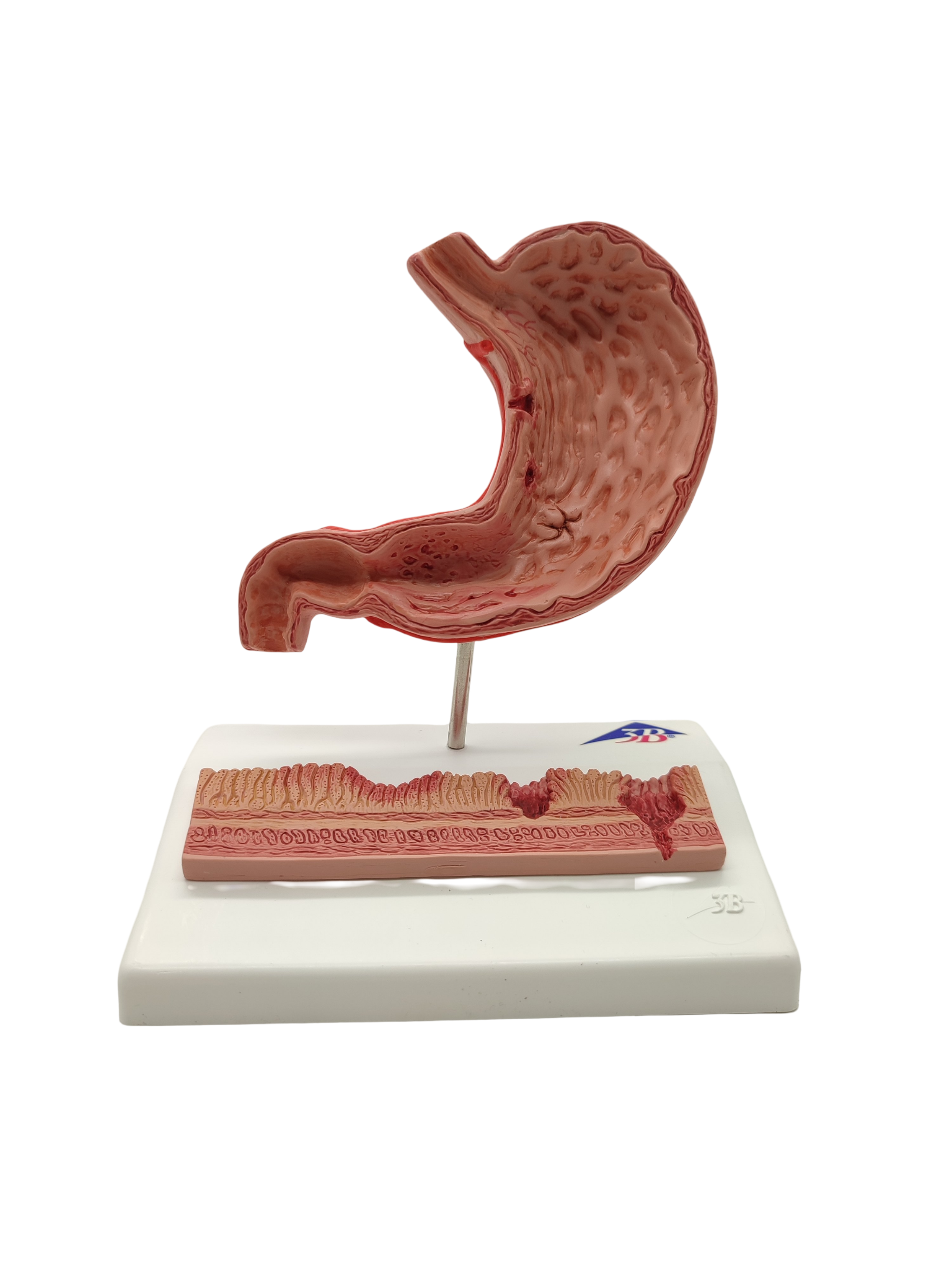 3B Scientific Magenmodell Anatomie mit Geschwüren 3B Smart Anatomy