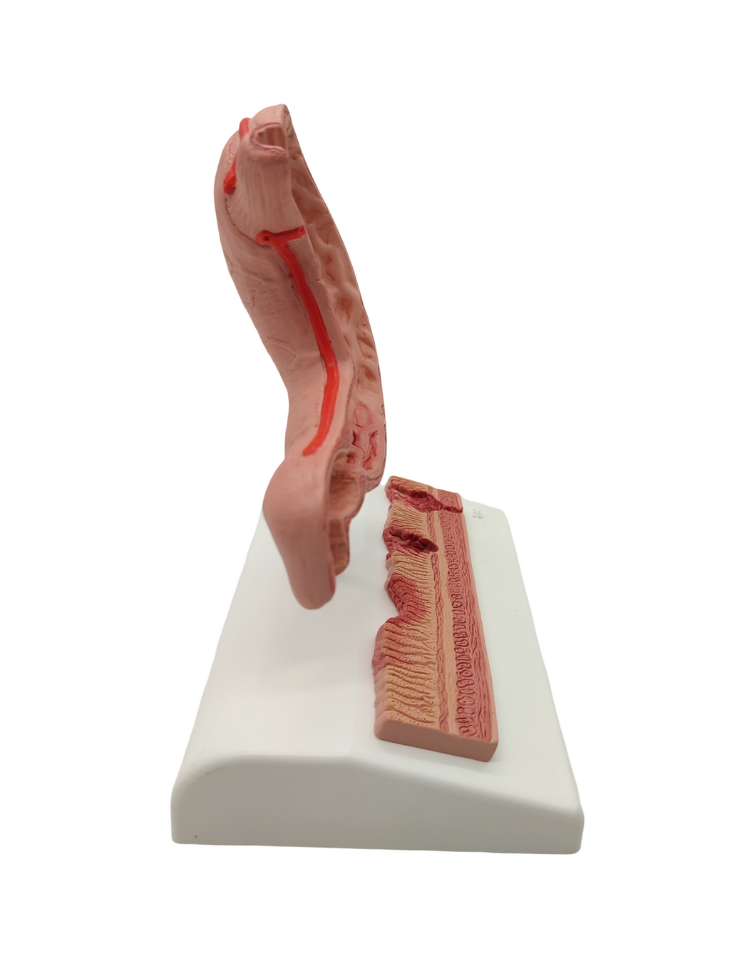 3B Scientific Magenmodell Anatomie mit Geschwüren 3B Smart Anatomy