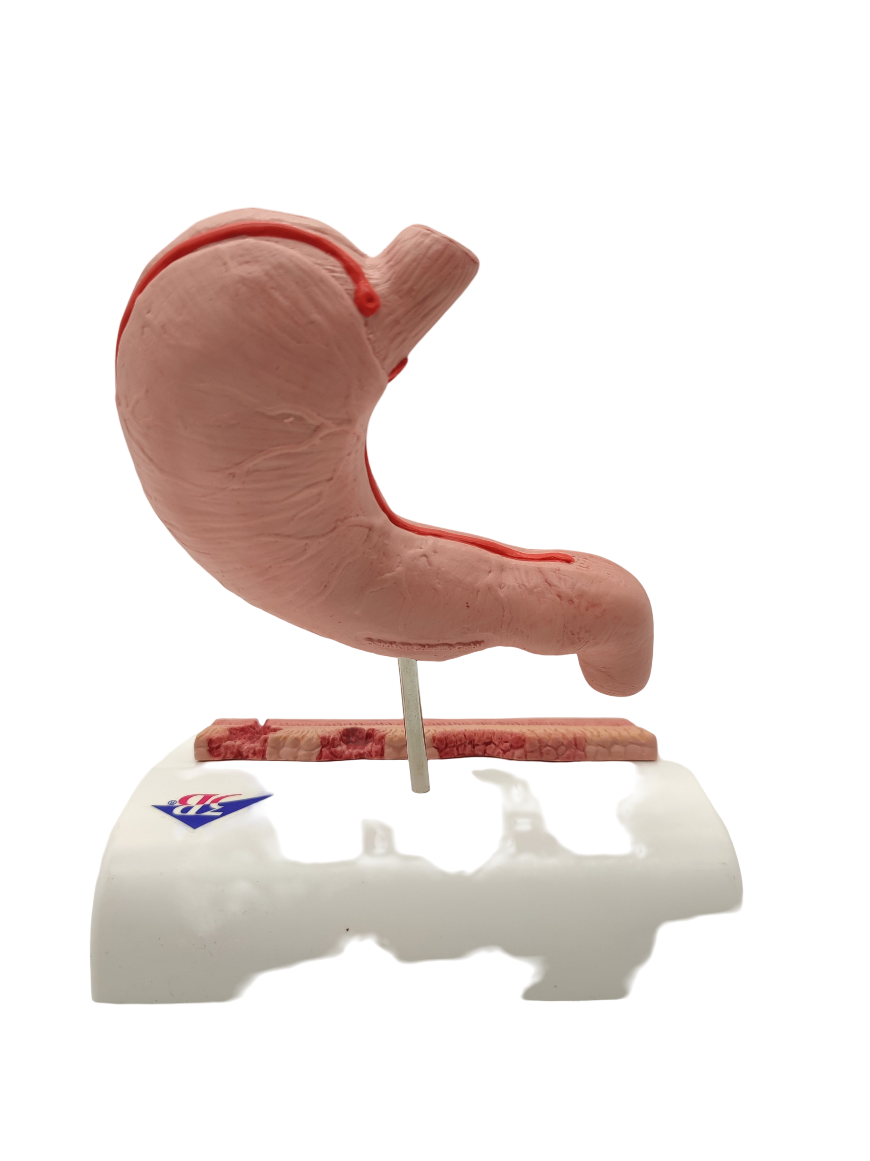 3B Scientific Magenmodell Anatomie mit Geschwüren 3B Smart Anatomy