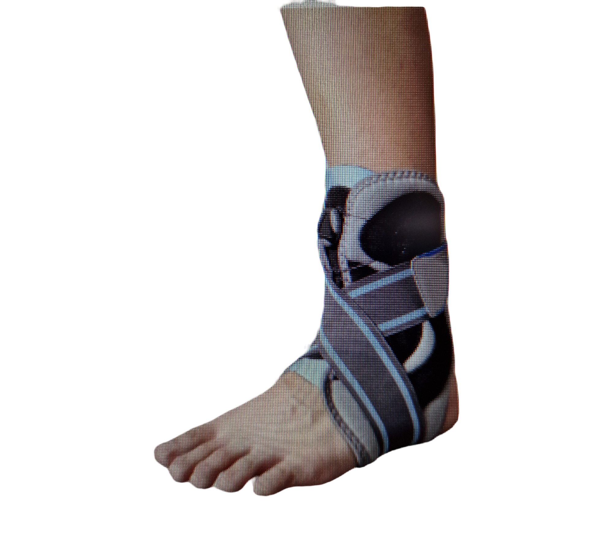 GIMA Knöchelstütze 42053 Q-Fit Verschluss Bandage Gr. XL