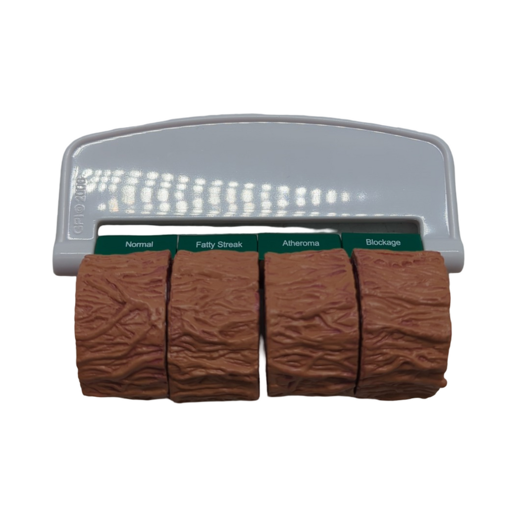 GPI Anatomicals Secciones arteriales Modell Set mit Henkel 4-teilig