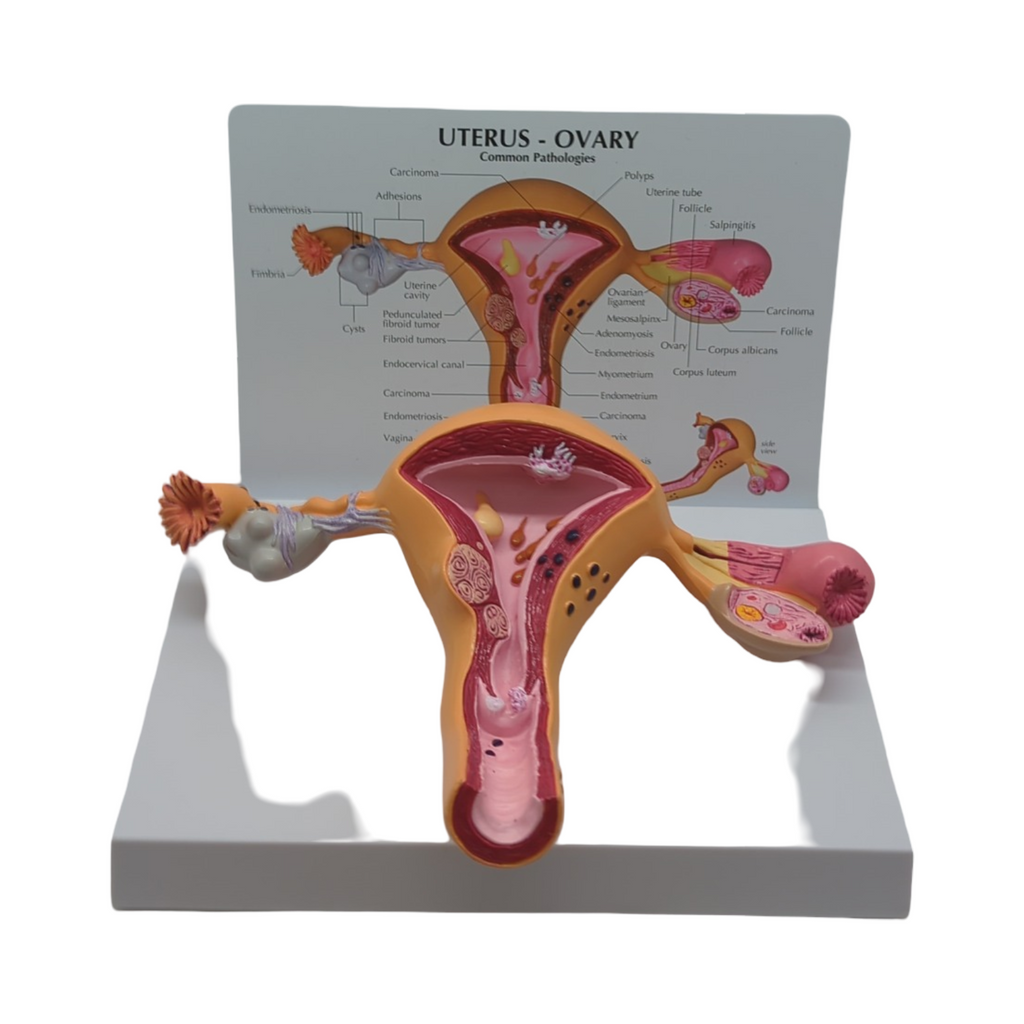 GPI Anatomicals Uterus-Ovar Modell anatomisches Lernmodell