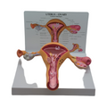 GPI Anatomicals Uterus-Ovar Modell anatomisches Lernmodell