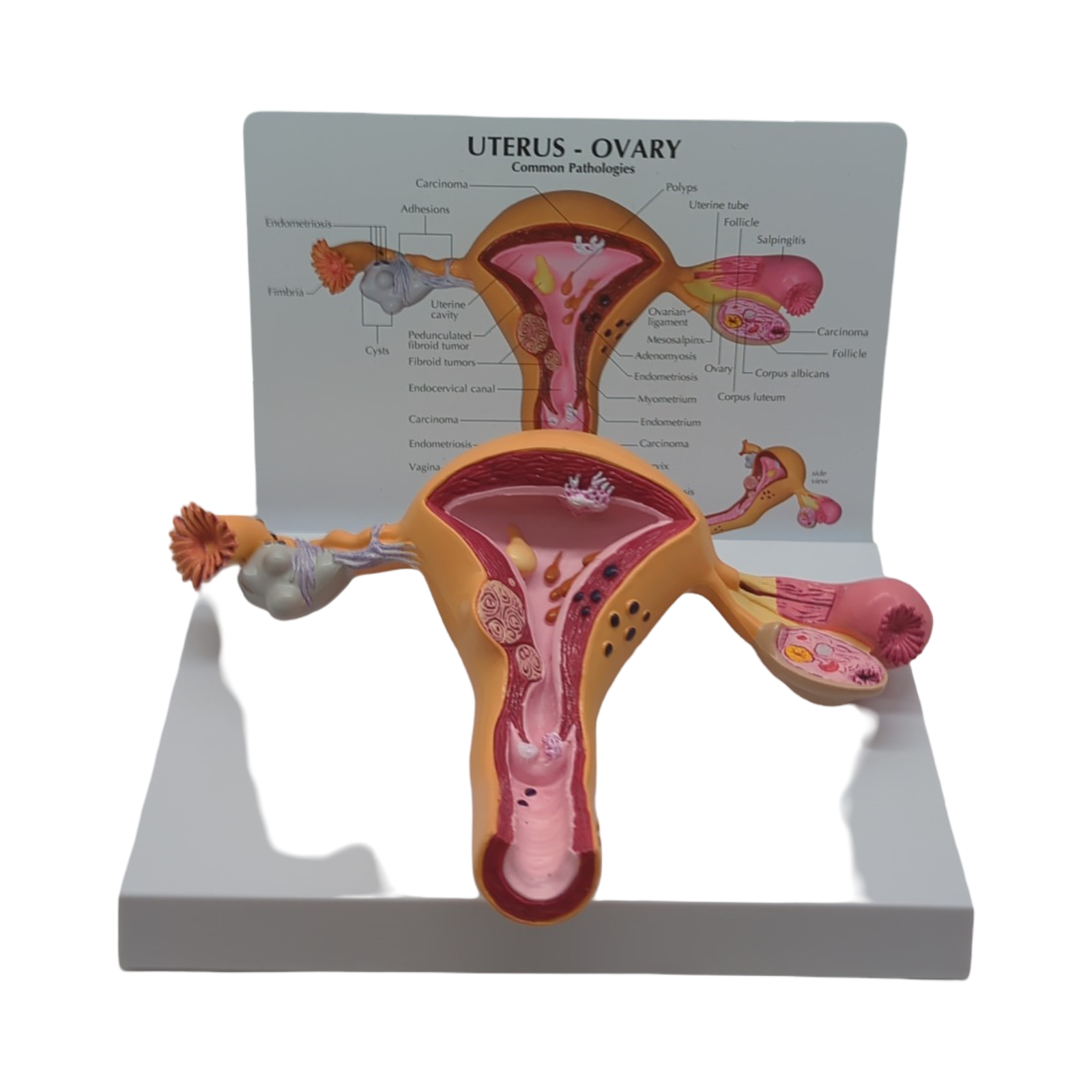 GPI Anatomicals Uterus-Ovar Modell anatomisches Lernmodell