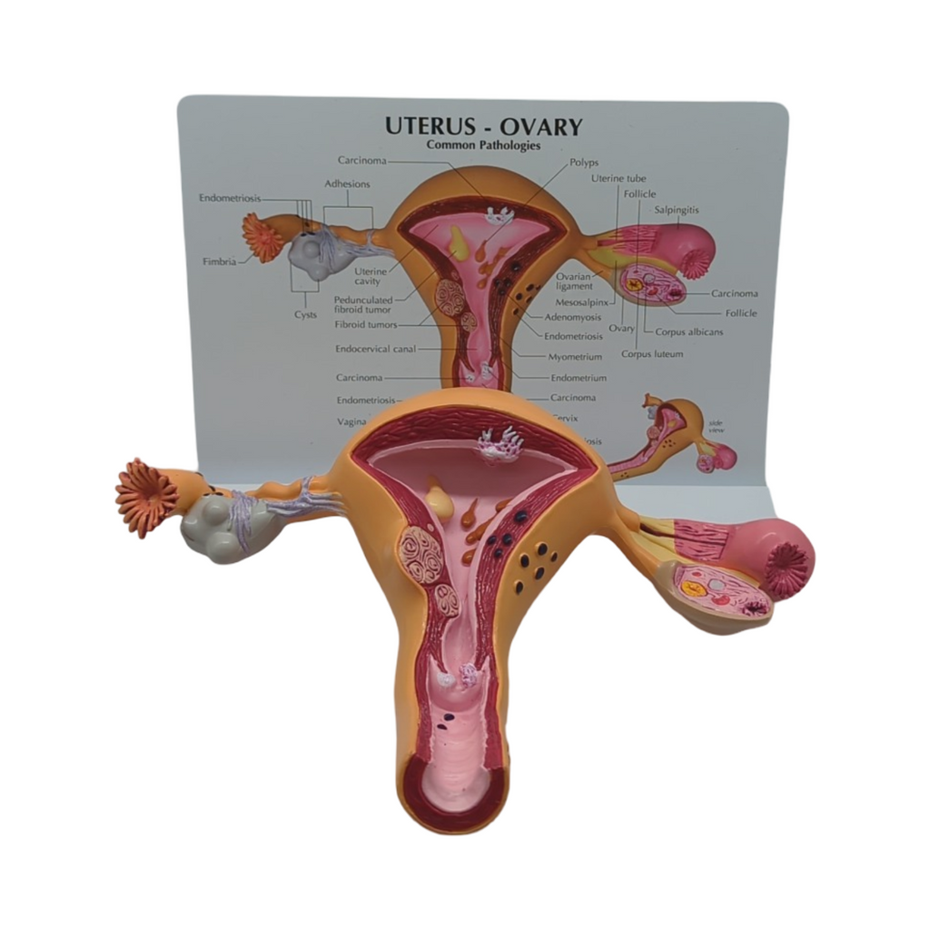 GPI Anatomicals Uterus-Ovar Modell anatomisches Lernmodell