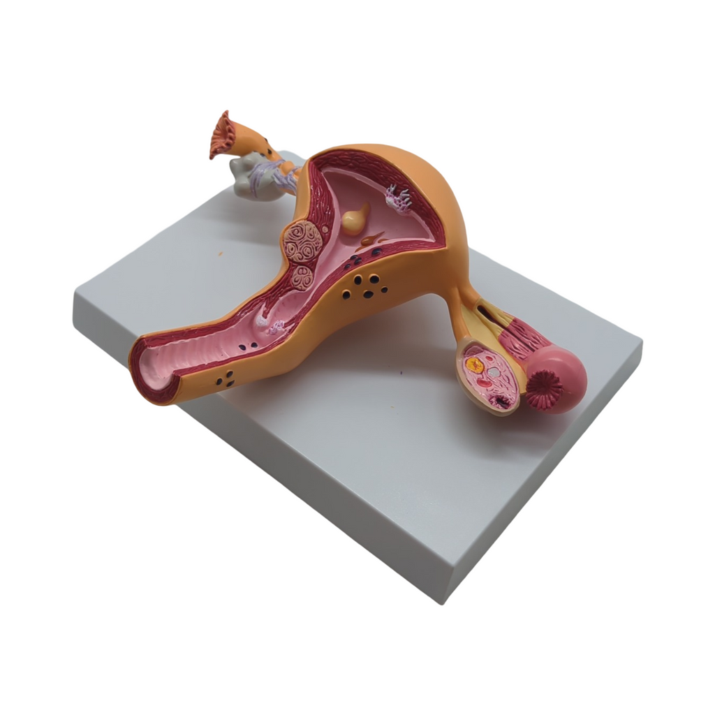 GPI Anatomicals Uterus-Ovar Modell anatomisches Lernmodell