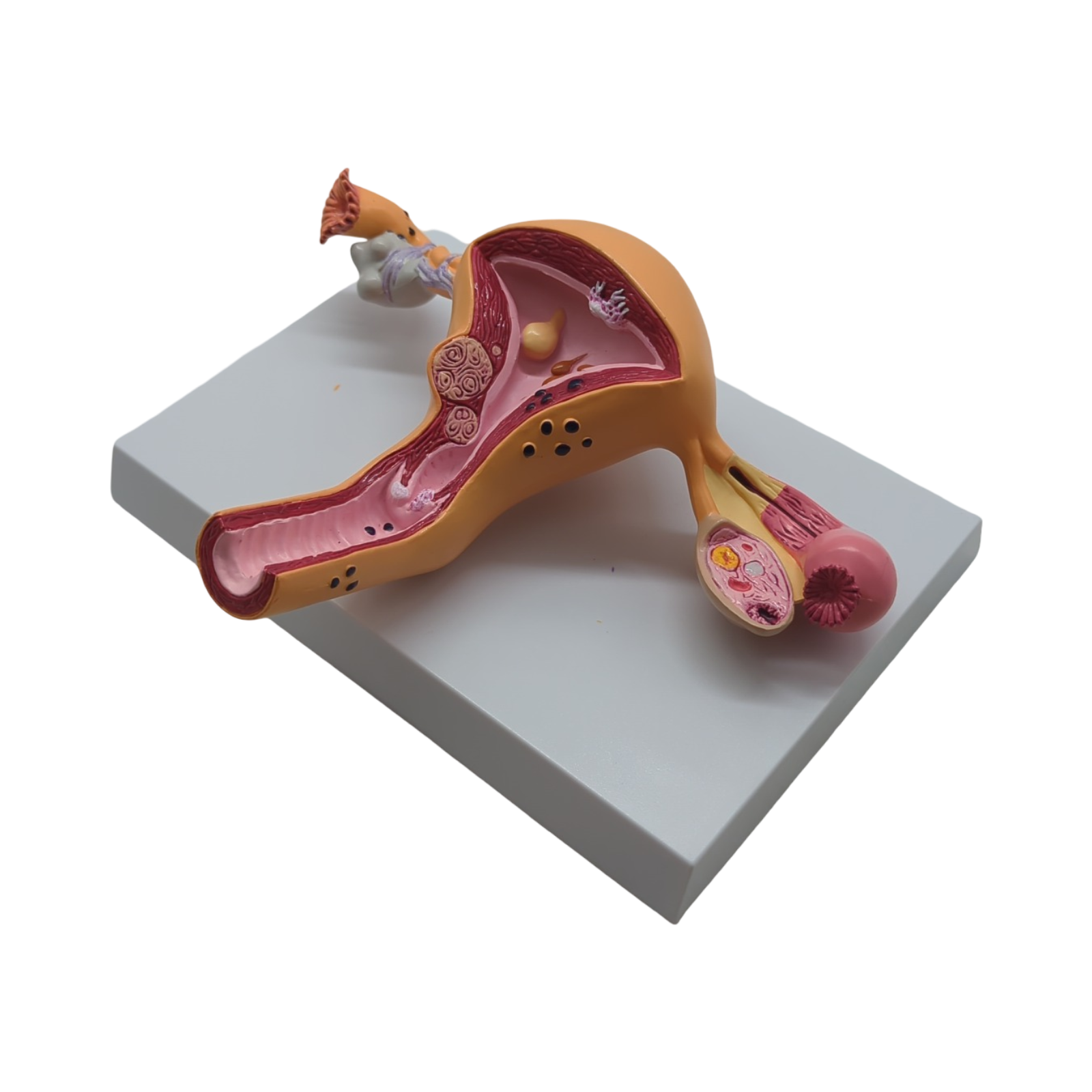 GPI Anatomicals Uterus-Ovar Modell anatomisches Lernmodell