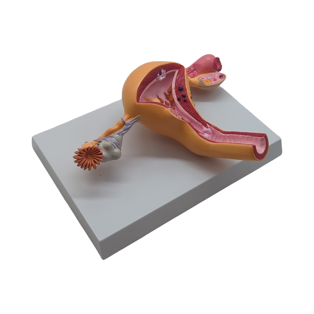 GPI Anatomicals Uterus-Ovar Modell anatomisches Lernmodell