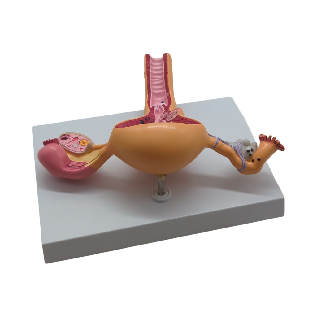 GPI Anatomicals Uterus-Ovar Modell anatomisches Lernmodell