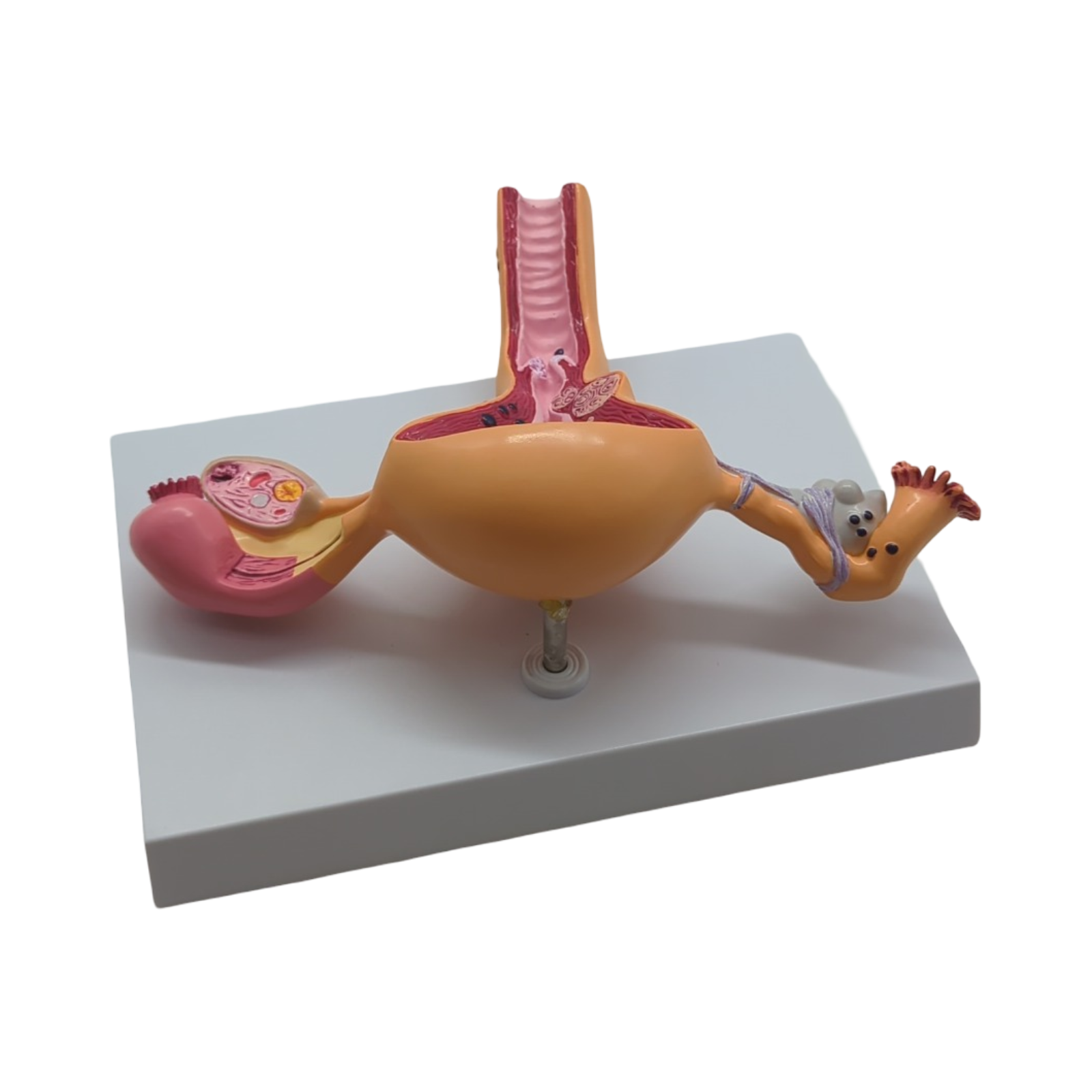 GPI Anatomicals Uterus-Ovar Modell anatomisches Lernmodell